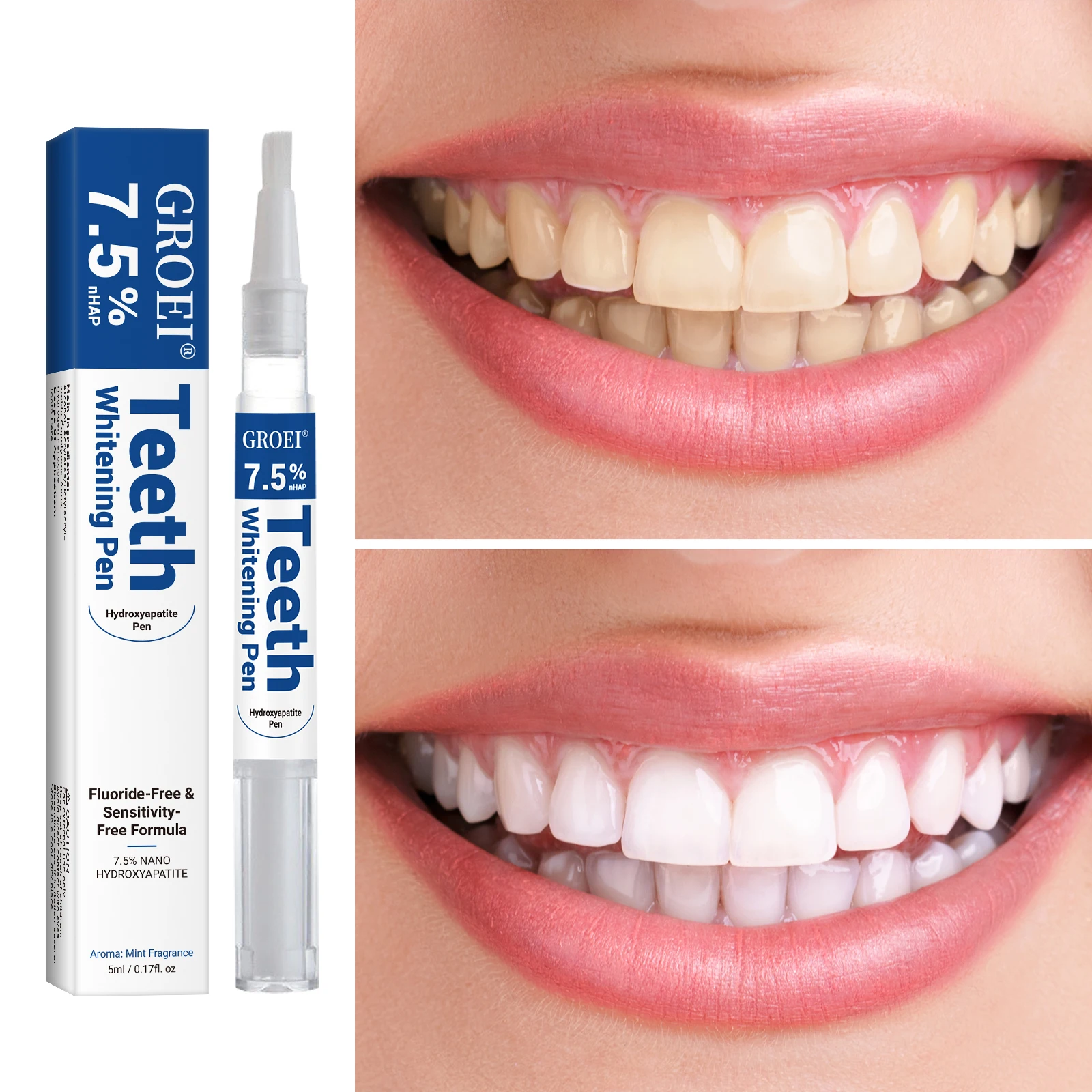 Caneta branqueadora de dente h - Teeth Whitening Price avaliação e preço