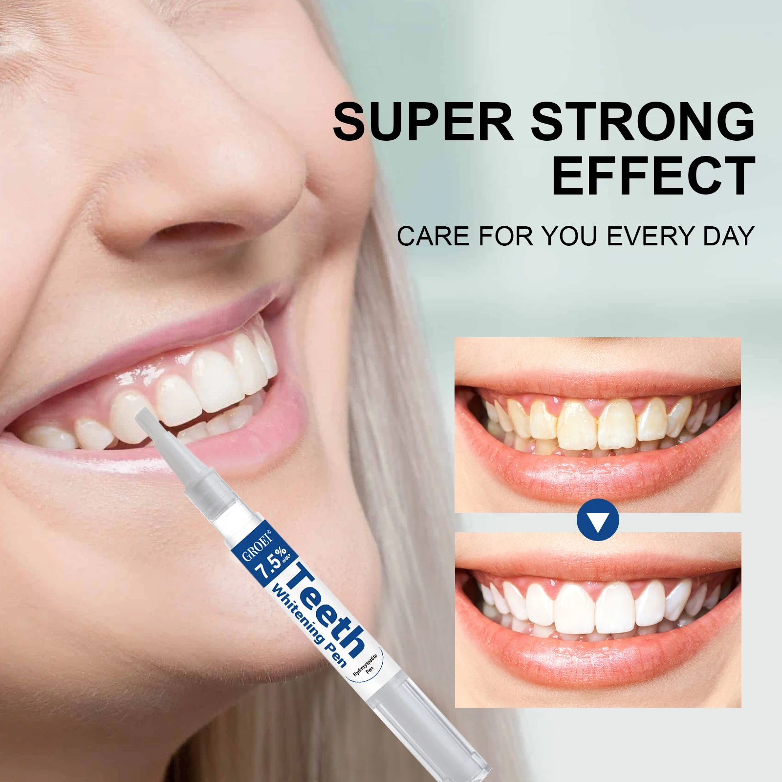 Caneta branqueadora de dente h - Teeth Whitening Price avaliação e preço