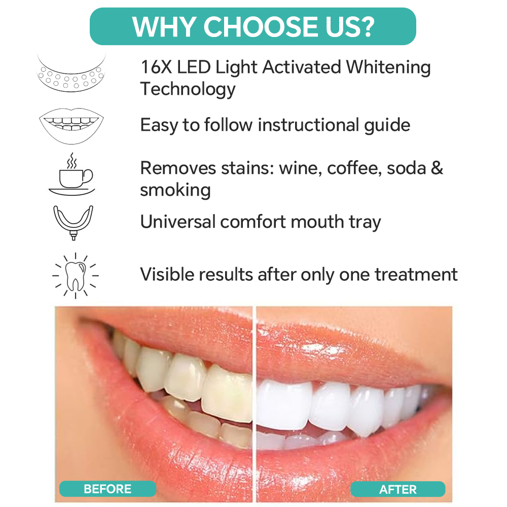 Luz Aceleradora de Clareamento - Led Mouth Tray avaliação e preço