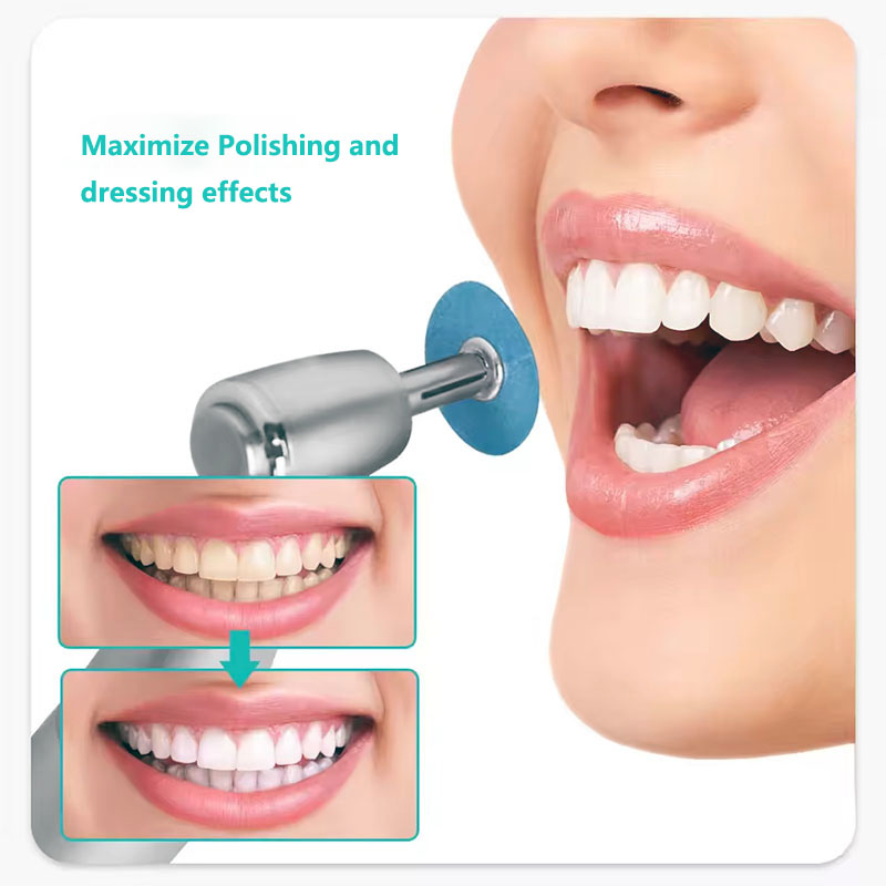 40 pçs discos de polimento den - Teeth Whitening Home avaliação e preço