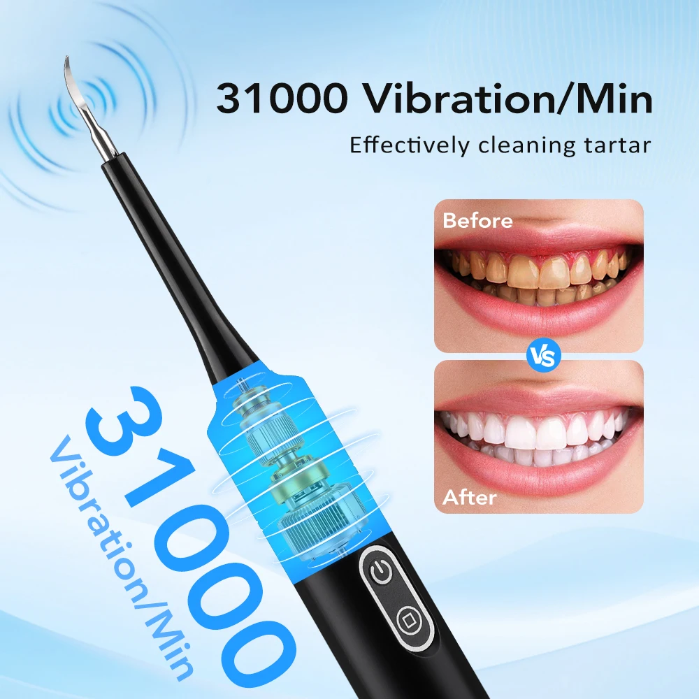 Escova de Dentes Elétrica com  - Teeth Whitening Home avaliação e preço